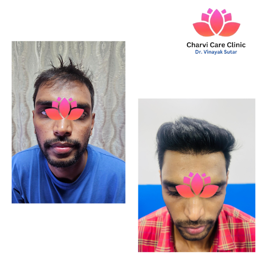 Treatment Progress Example