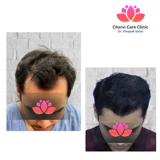 Hair Treatment Result Example