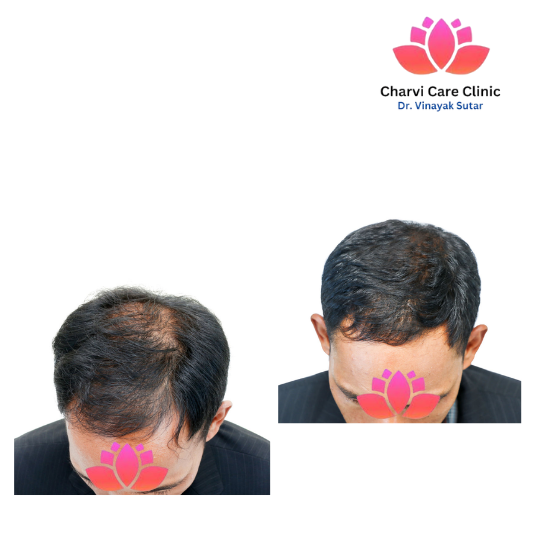 Treatment Progress Example